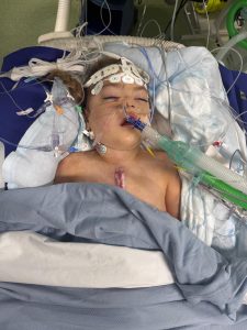 Paisley-Rose recovers from surgery at Evelina Hopsital